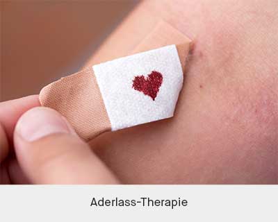 aderlass-therapie